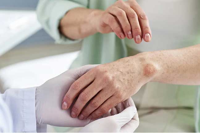  Autoimmune Disorders Homeopathy Treatment in Pimpri