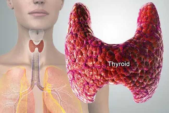 Best Homeopathy Thyroid Treatment in Pimpri